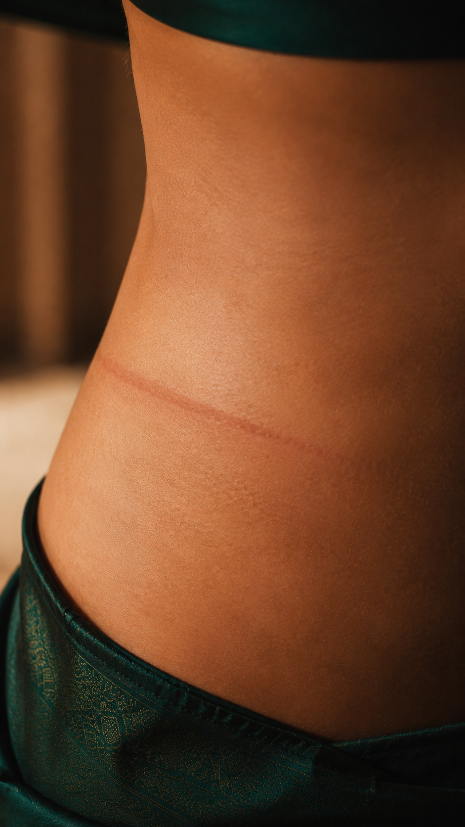 Close-up of a red pressure mark on a woman's waist from a petticoat drawstring, saree fabric visible below